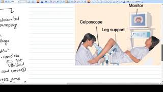 Colposcopy  Brief Idea [upl. by Derrik]