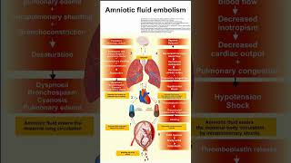 AMNIOCENTESIS  MATERNAL HEALTH  PRENATAL TESTING [upl. by Anaeirb]