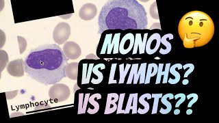 How I distinguish between Lymphocytes vs Monocytes [upl. by Eegnat761]