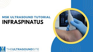 How to view the Infraspinatus tendon on ultrasound [upl. by Enial]