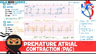 Rate and Rhythm  Premature Atrial Contraction PAC [upl. by Harraf]