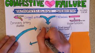 Congestive Heart Failure Pathophysiology [upl. by Adria]