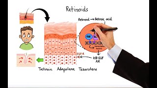 Pharmacology  ACNE TREATMENTS MADE EASY [upl. by Hpsoj]